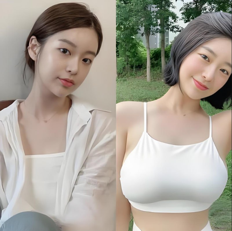 Mandy 豐胸前後對比